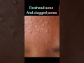 Why Scalp Health Affects Your Face | Skincare Tips
