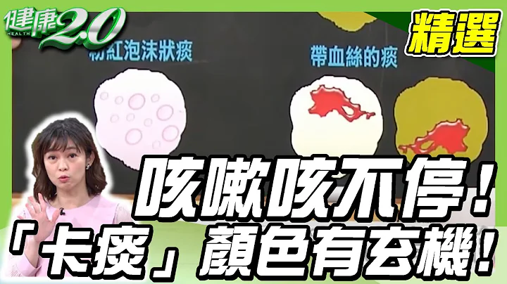 咳嗽咳不停！小心妳的「卡痰」顏色有玄機！【健康2.0精選】 - 天天要聞