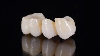 Cadcam Training - Lava Esthetic With Miyo Glaze Part Two