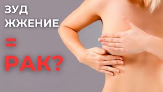 Корочки и выделения из соска | Рак Педжета (рак соска)