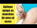 Você não terá vergonha da sua virilha axilas joelho escuro se passar isso