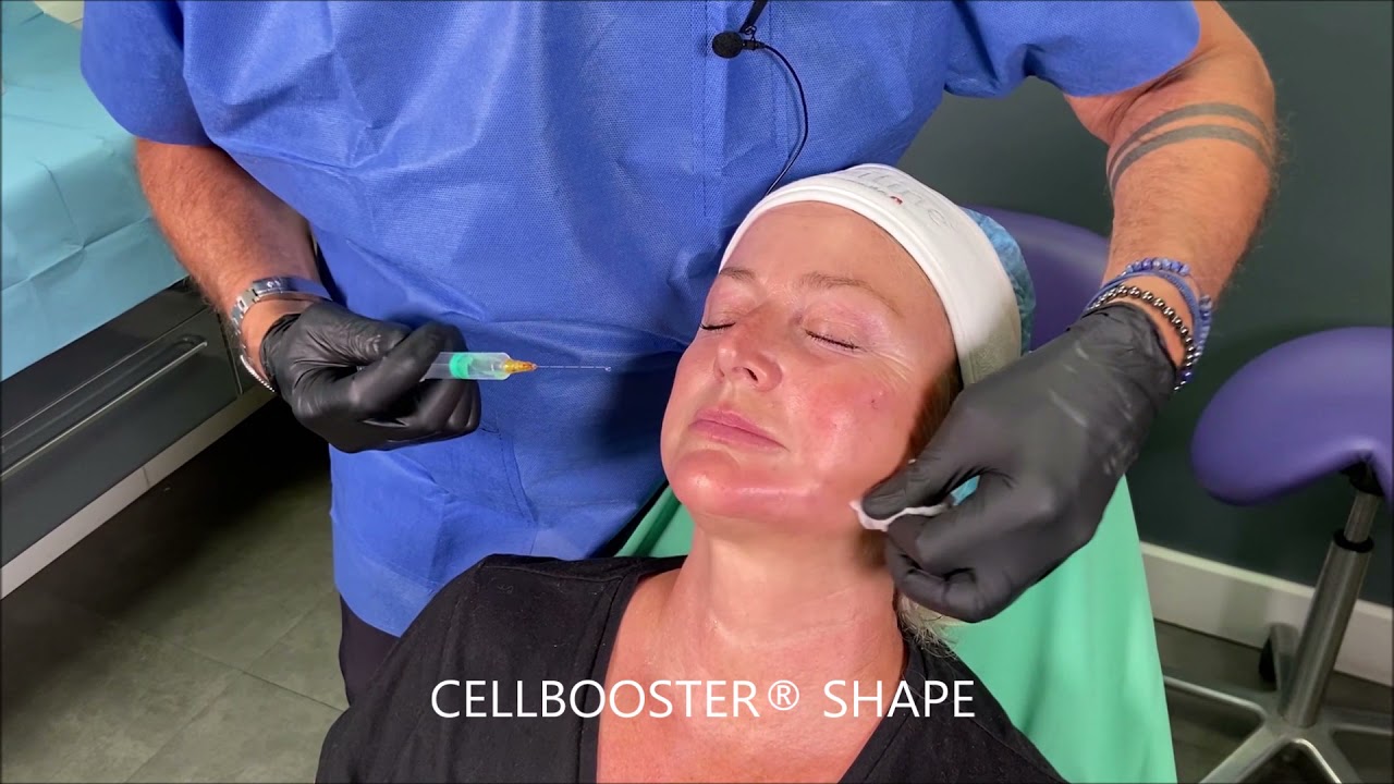 CELLBOOSTER® SHAPE, LIFT & GLOW Combination Treatment & Injections  techniques by Dr. Hervé PADEY 