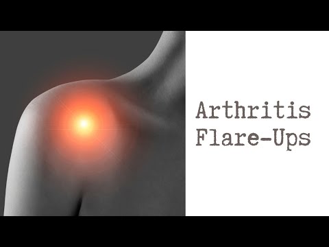 How to Deal with an Arthritis Flare-Up