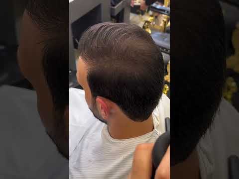 بودرة ألياف الكيراتين لتكثيف الشعر الحل السريع للشعر الخفيف والفراغات 2