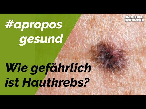 Video: Was Ist Hautkrebs?