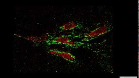iPSC focal adhesions
