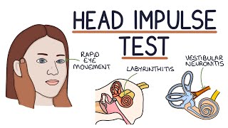 The Head Impulse Test