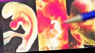 [Documentaire] L&#39;IVG / AVORTEMENT en vérité : qu&#39;avorte-t-on ? Bébé ou cellules ?