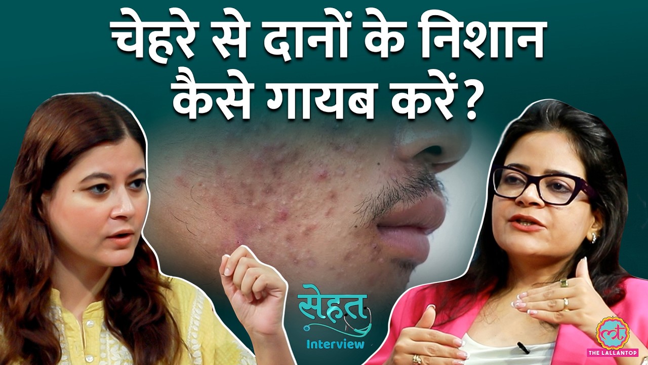 Pimples, Acne, Acne Scars, Dark Circles, Dry Skin सबसे छुटकारा | Sehat Interview #5