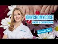 Les onychomycoses, des champignons dans les ongles, comment les soigner ? #DermatoDrey