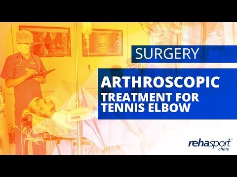 Arthroscopic treatment for tennis elbow