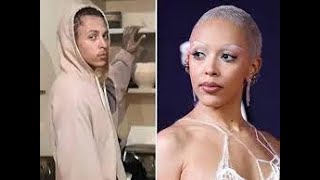 Shoking🥶Doja Cat’s brother knocked her teeth out, singer’s mom claims😑