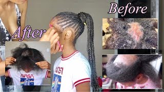 UPDATE: Jaelyns' Progress with a bomb hairdo to celebrate