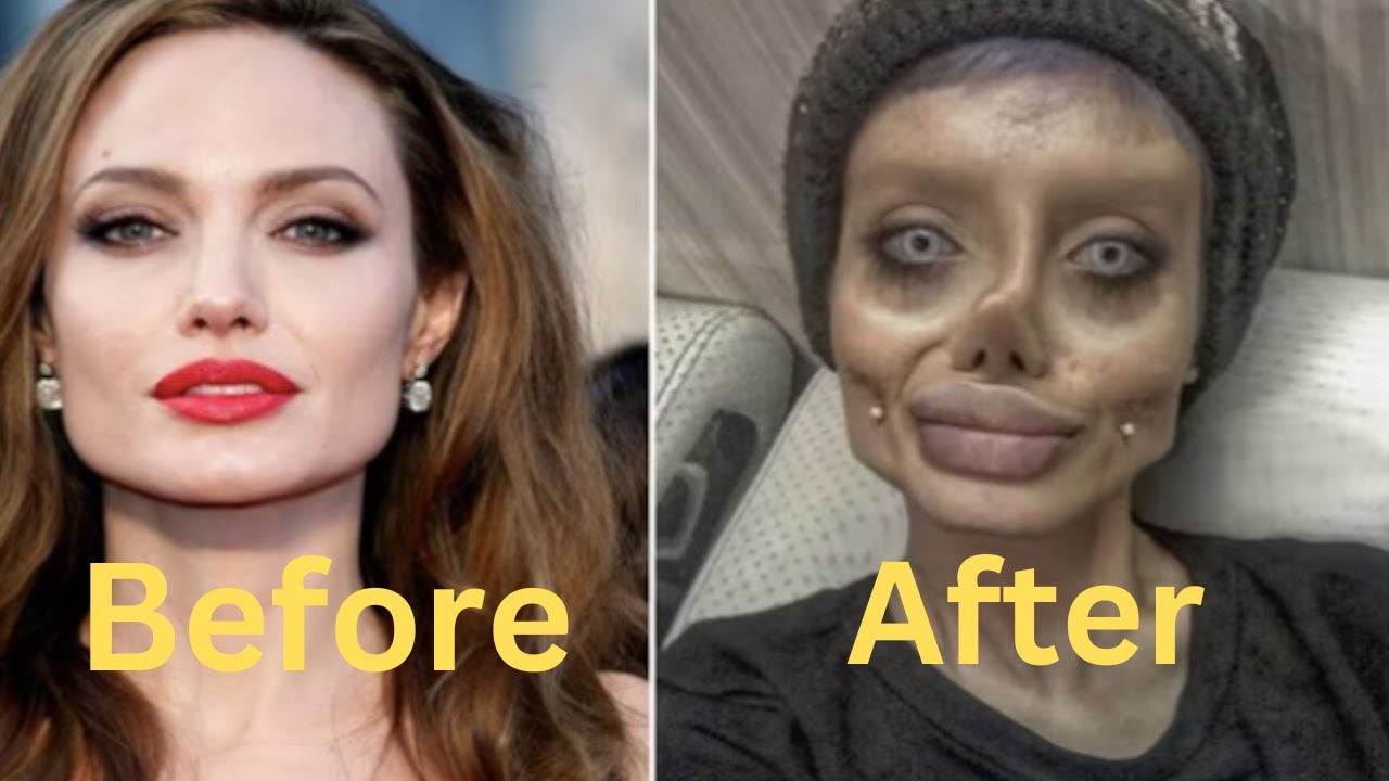 10 Celebrity Plastic Surgery Disasters That Shocked Hollywood YouTube 10 Celebrity Plastic Surgery Disasters That Shocked Hollywood YouTube