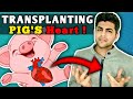 Pig’s Heart Transplanted to Man | First Ever Heart Xeno-Transplant | What is Organ Transplant ?