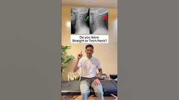 Stretch your straight neck away!! #spondylosis