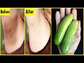 Whiten Dark Underarms Instantly Permanently cucumber mix with lime and honey | 100% Works At Home