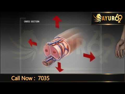 Testosterone Male Infertility