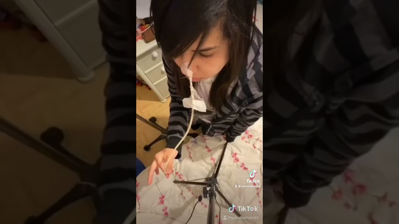 Living with a feeding tube be like :