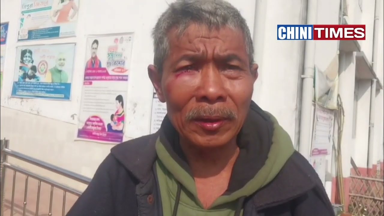 Kanchanpur wo Truck Tiper by High Speed no khaiyak ha hinkhe 4 bosor ma Chrei keha thoi ha jaga wo!!