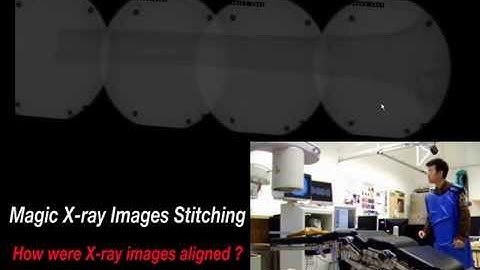 Magic X-ray Stitching