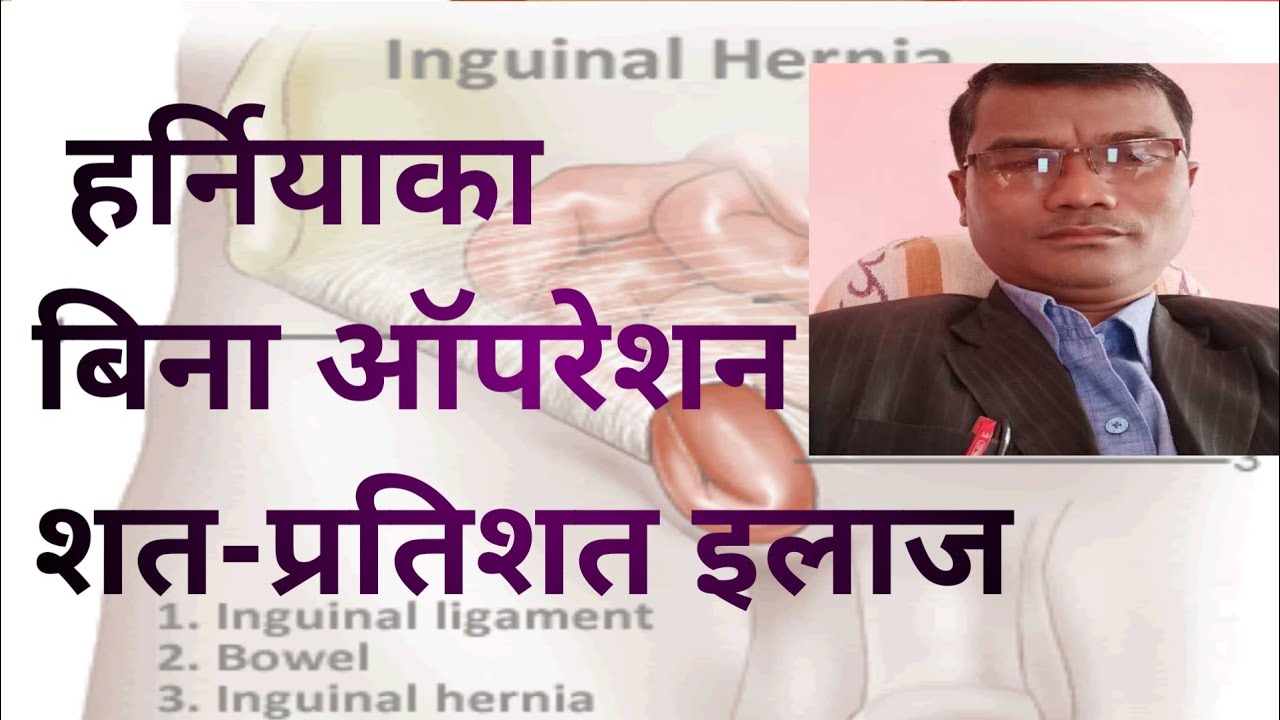 Hernia treatment without surgeryHernia treatment at Home YouTube