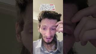 please donate via the gofundme link in bio so I can pay for my treatment viral