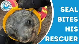 Seal Bites His Rescuer