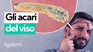 Demodex Chi Sono Gli Acari Del Viso E Cosa Fanno Sulla Nostra Pelle