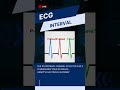 Master the ECG Rhythm: Essential Waves &amp; Intervals Explained