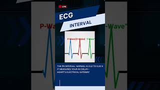 Master the ECG Rhythm: Essential Waves &amp; Intervals Explained
