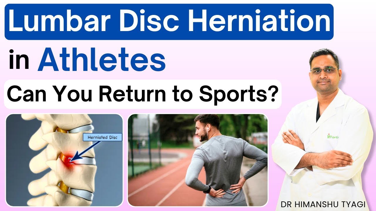 Lumbar Disc Herniation in Athletes: Can You Return to Sports? | Endoscopic Spine Surgery