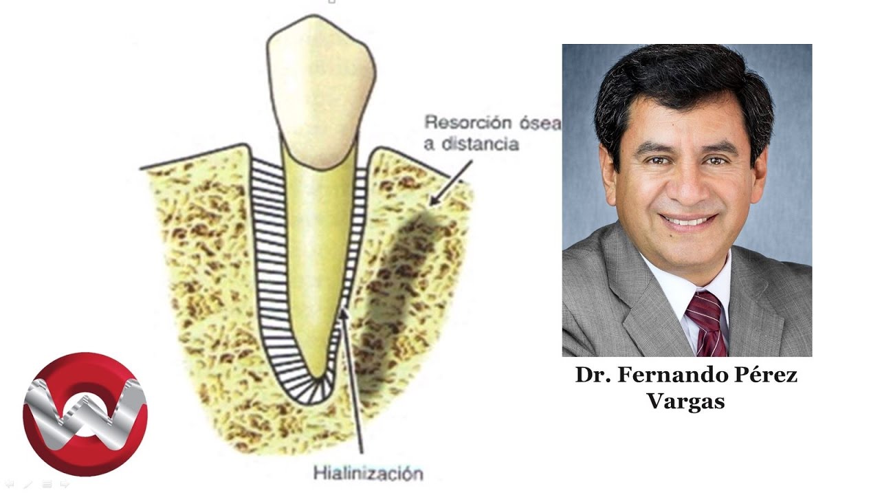 BIOMECANICA DEL MOVIMIENTO DENTARIO PDF