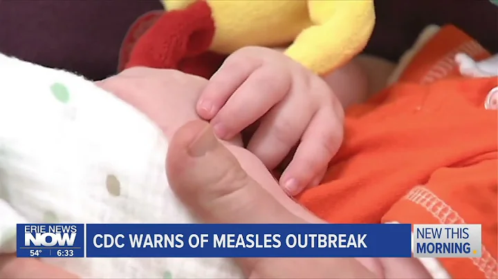 CDC warns that Measles cases are on the Rise