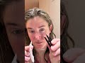 Scleral Lens Morning Routine