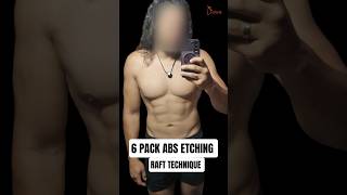 6 Pack Abs Etching with RAFT Technique | Male Body Contouring Result | International Patient