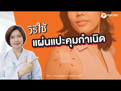 วิธีใช้แผ่นแปะคุมกำเนิด | Telepharmacy 1 นาทีกับเภสัชกร Fascino