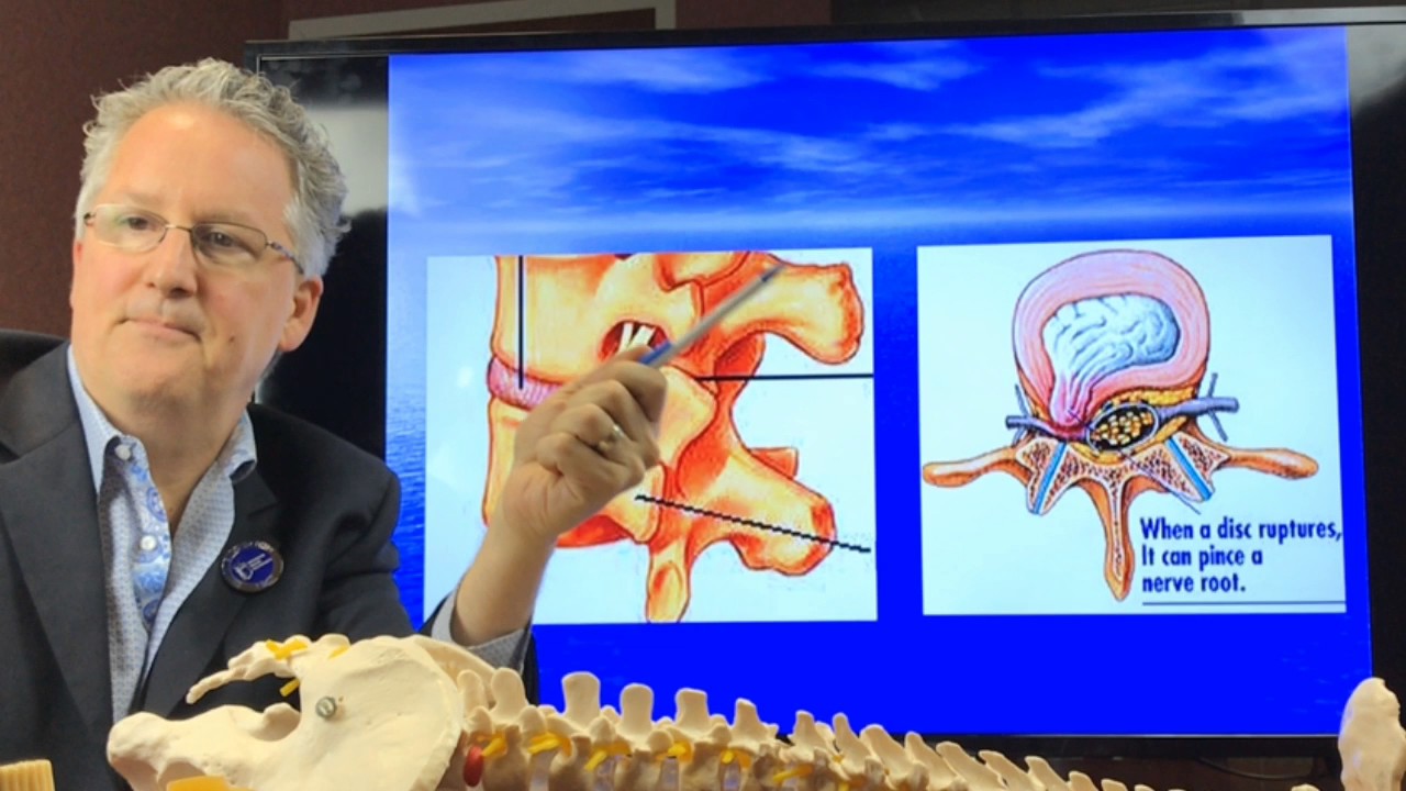 What is a Herniated Disc and What are the Symptoms? sciatica treatment medication