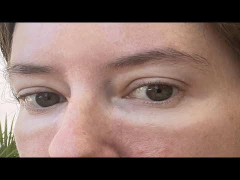 how to get rid of glasses tan line on nose