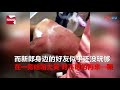 Wedding Groom Whipped, Has Salt Poured in Open Wounds in Cruel ‘Wedding Prank’ in China