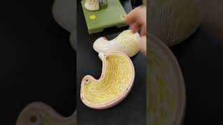 Stomach & Stomach Wall