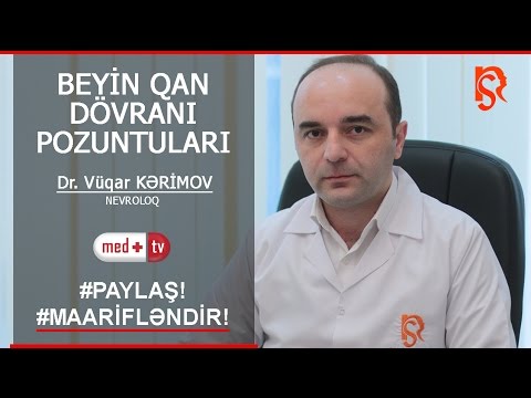 Beyin qan dovrani pozgunlugu - Hekim Nevroloq Vuqar Kerimov İstanbulNS