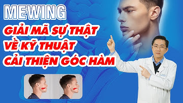 Mewing là gì? Câu hỏi thường gặp về Mewing | Nam Bùi Vinalign