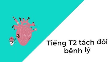 Một số tiếng tim bất thường hay gặp  T2 tách đôi, T2 mờ, T1 đanh, tiếng ngựa phi,