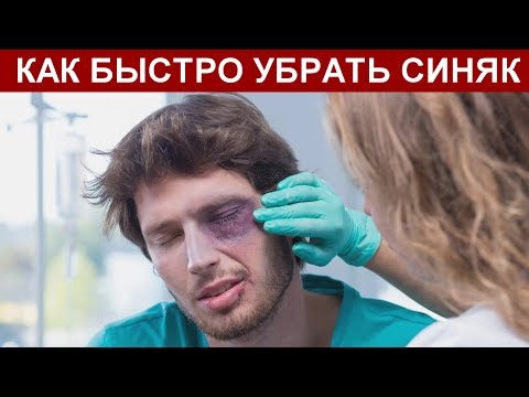 СИНЯК ПОД ГЛАЗОМ, КАК БЫСТРО УБРАТЬ В ДОМАШНИХ УСЛОВИЯХ