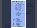 Lateral Corticospinal Tract Explained in 60 Seconds