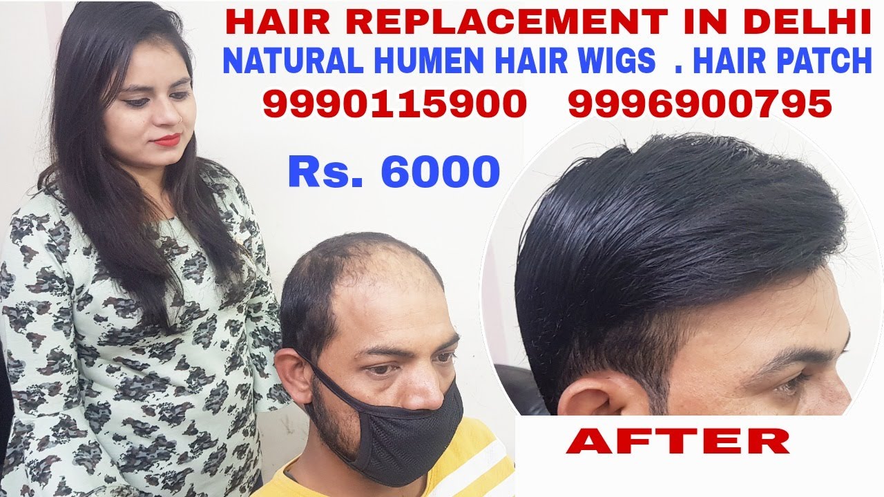 Permanent Hair Wigs For Men || Hair Wigs In Delhi || Hair Wigs Shop ...