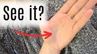 SEED TICKS and the MOST EFFECTIVE way to kill them