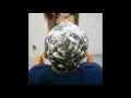 発毛 育毛 デンサーヘアーを８ヶ月使用した実例を追ってみました。東京 原宿 原宿美容室 yippee
