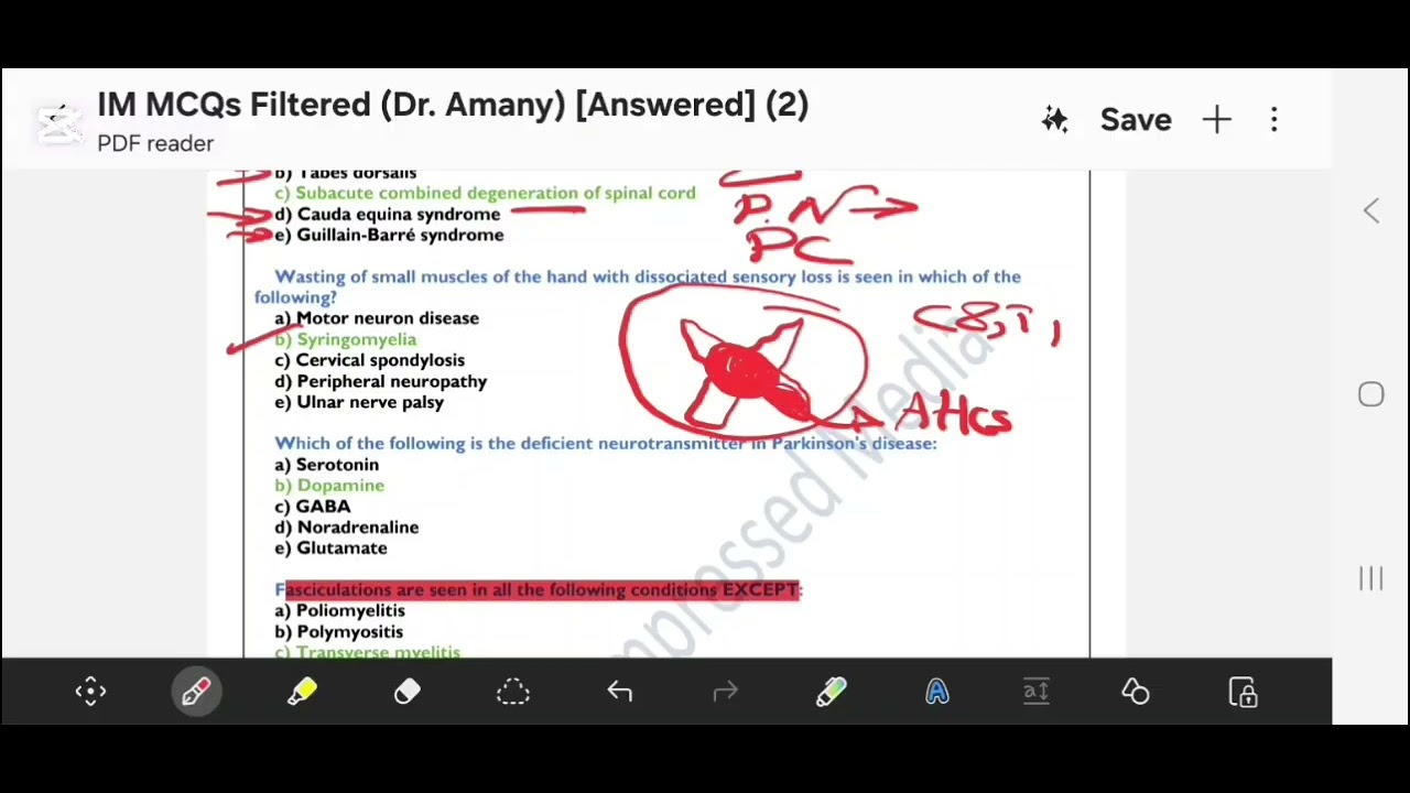 Internal Medicine: Neurology MCQs (Part 1/2)